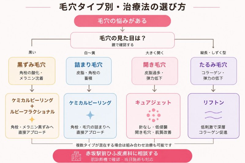 毛穴タイプ別の治療方法の選び方説明